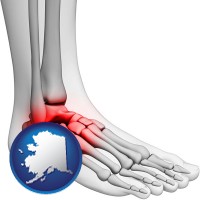 alaska map icon and a foot and ankle, showing the inflamed area in red