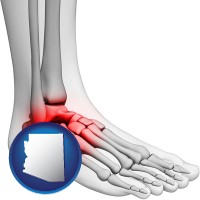 arizona map icon and a foot and ankle, showing the inflamed area in red