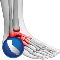 california map icon and a foot and ankle, showing the inflamed area in red