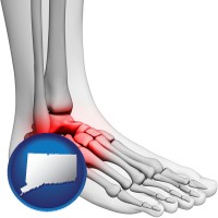 connecticut map icon and a foot and ankle, showing the inflamed area in red