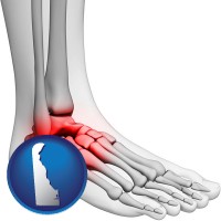 delaware map icon and a foot and ankle, showing the inflamed area in red
