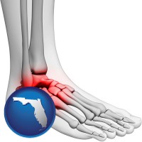 florida map icon and a foot and ankle, showing the inflamed area in red