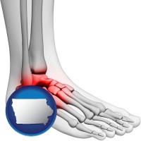 iowa map icon and a foot and ankle, showing the inflamed area in red