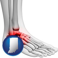indiana map icon and a foot and ankle, showing the inflamed area in red