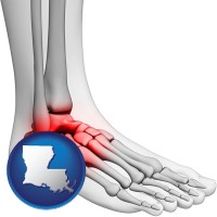 louisiana map icon and a foot and ankle, showing the inflamed area in red