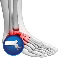 massachusetts map icon and a foot and ankle, showing the inflamed area in red