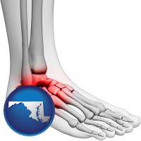 maryland map icon and a foot and ankle, showing the inflamed area in red