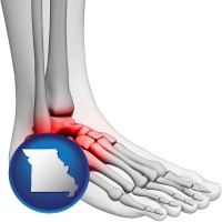 missouri map icon and a foot and ankle, showing the inflamed area in red