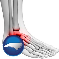 north-carolina map icon and a foot and ankle, showing the inflamed area in red