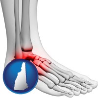 new-hampshire map icon and a foot and ankle, showing the inflamed area in red