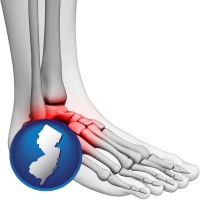 new-jersey map icon and a foot and ankle, showing the inflamed area in red