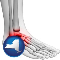 new-york map icon and a foot and ankle, showing the inflamed area in red