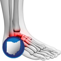ohio map icon and a foot and ankle, showing the inflamed area in red