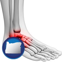 oregon map icon and a foot and ankle, showing the inflamed area in red