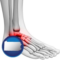 pennsylvania map icon and a foot and ankle, showing the inflamed area in red