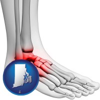 rhode-island map icon and a foot and ankle, showing the inflamed area in red