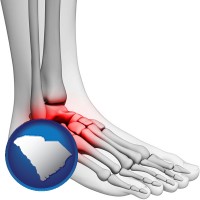 south-carolina map icon and a foot and ankle, showing the inflamed area in red
