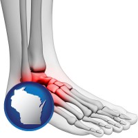 wisconsin map icon and a foot and ankle, showing the inflamed area in red