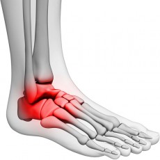 a foot and ankle, showing the inflamed area in red
