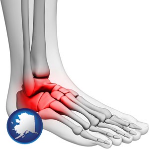 a foot and ankle, showing the inflamed area in red - with Alaska icon