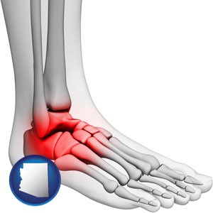a foot and ankle, showing the inflamed area in red - with Arizona icon