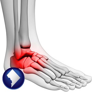a foot and ankle, showing the inflamed area in red - with Washington, DC icon