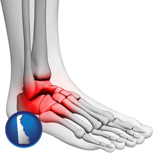 a foot and ankle, showing the inflamed area in red - with Delaware icon