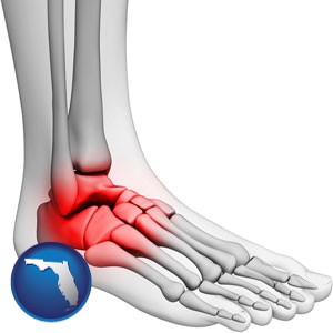 a foot and ankle, showing the inflamed area in red - with Florida icon