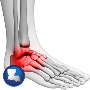 a foot and ankle, showing the inflamed area in red - with Louisiana icon