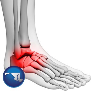 a foot and ankle, showing the inflamed area in red - with Maryland icon