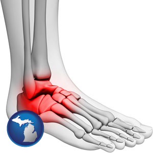 a foot and ankle, showing the inflamed area in red - with Michigan icon