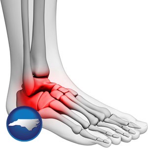 a foot and ankle, showing the inflamed area in red - with North Carolina icon