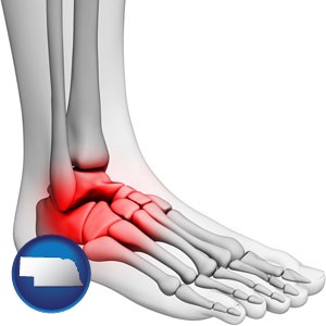 a foot and ankle, showing the inflamed area in red - with Nebraska icon