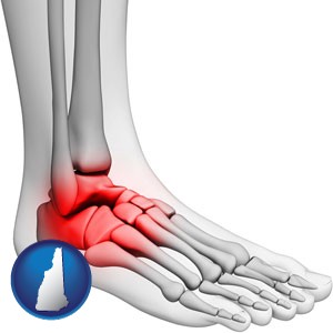 a foot and ankle, showing the inflamed area in red - with New Hampshire icon