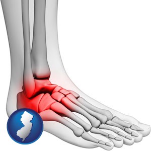 a foot and ankle, showing the inflamed area in red - with New Jersey icon