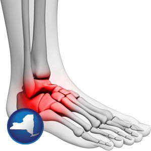 a foot and ankle, showing the inflamed area in red - with New York icon