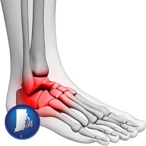 a foot and ankle, showing the inflamed area in red - with Rhode Island icon