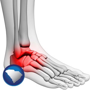 a foot and ankle, showing the inflamed area in red - with South Carolina icon