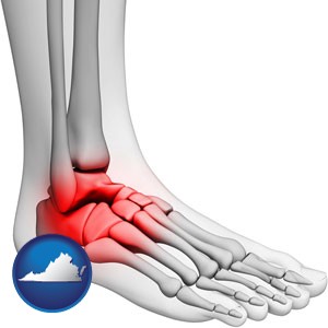 a foot and ankle, showing the inflamed area in red - with Virginia icon
