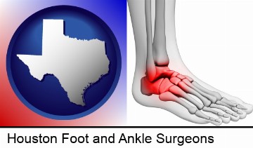 a foot and ankle, showing the inflamed area in red in Houston, TX