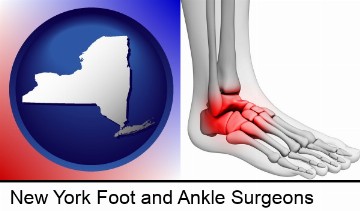 a foot and ankle, showing the inflamed area in red in New York, NY